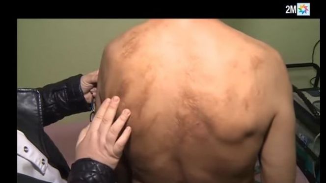 تعذيب تعذيب