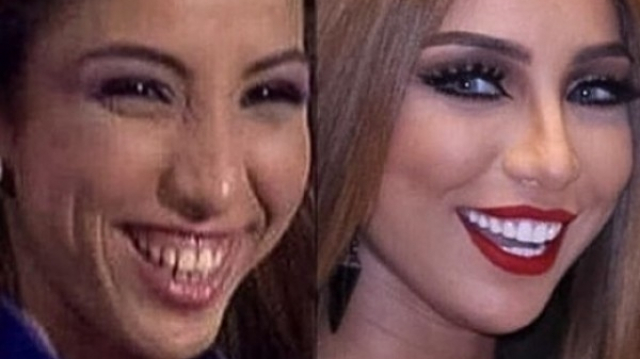 dounia batma dounia batma