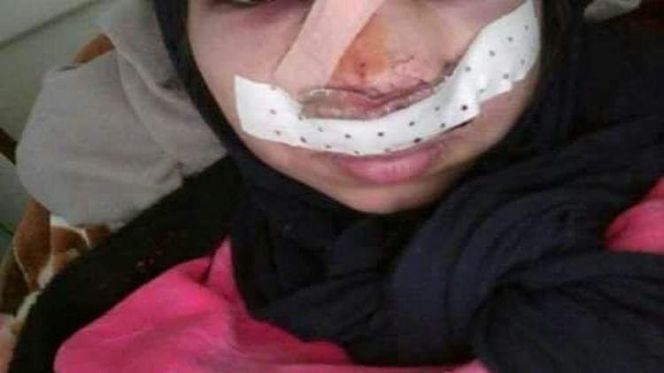 معنفة معنفة