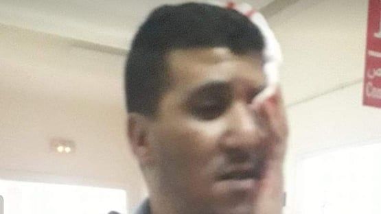 ضحية اعتداء ضحية اعتداء