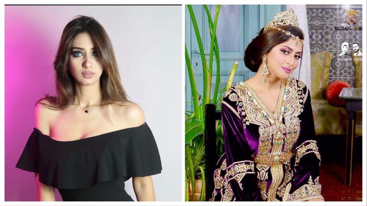 بعد خضوعها للتجميل شروق الشلواطي تشبه نفسها بأمينة كرم Www Le360 Ma