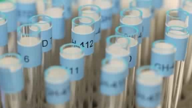 Lutte antidopage-2 Lutte antidopage-2