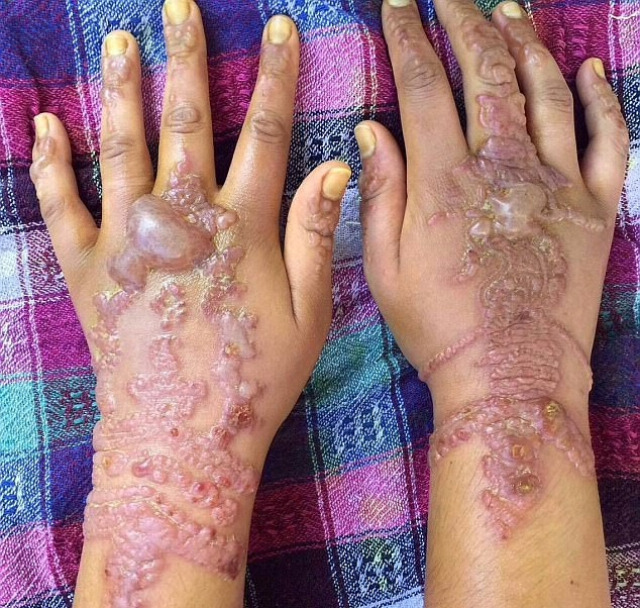Agadir Un Tatouage Au Henné Vire Au Cauchemar Wwwle360ma