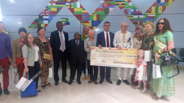 SCB Cameroun et albinos