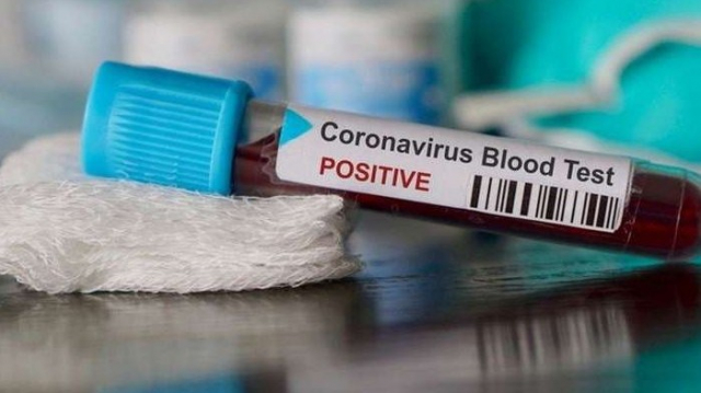 coronavirus coronavirus