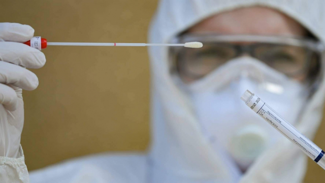 Coronavirus dépistage Coronavirus dépistage