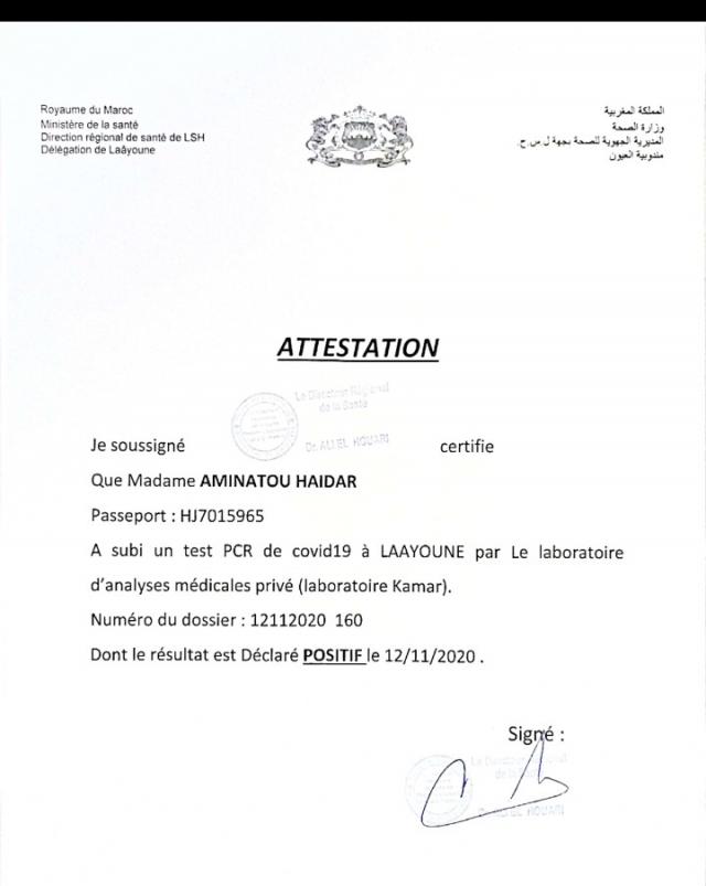 Test PCR Aminatou Haidar Test PCR Aminatou Haidar