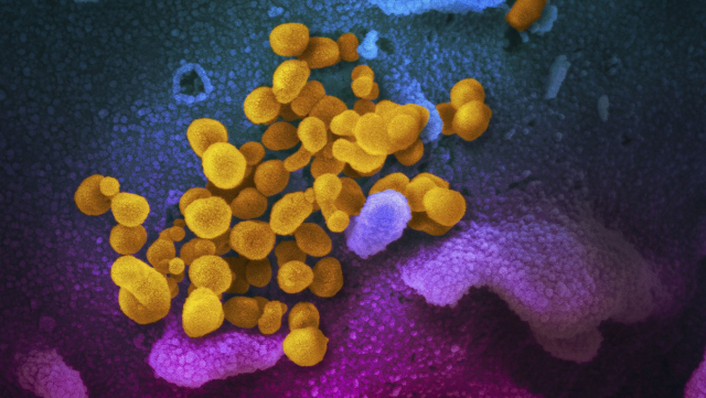 Le coronavirus au microscope Le coronavirus au microscope