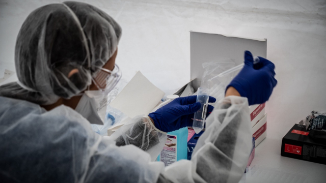 Test salivaire - Covid 19 - laboratoire - analyses - Coronavirus Test salivaire - Covid 19 - laboratoire - analyses - Coronavirus