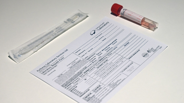 Test PCR - Prélèvement - Faux tests PCR Test PCR - Prélèvement - Faux tests PCR