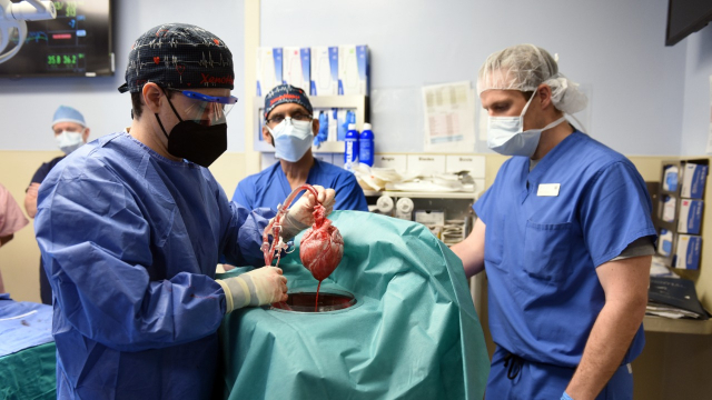 Chirurgie - Etats-Unis - Greffe d un coeur de porc - Transplantation cardiaque - Maryland - Université du Maryland - Chirurgie