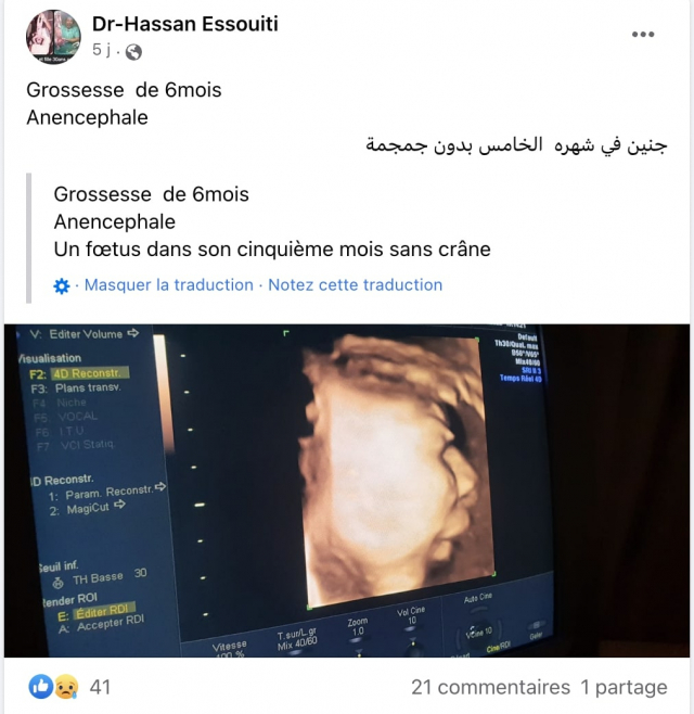 Facebook post - Screenshot - Facebook account Dr Hassan Essouiti - Gynecologist-obstetrician of Safi - IVG - Abortion in Morocco