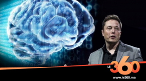 Cover Vidéo - L’implant cérébral d’Elon Musk, la science fiction dépasse la réalité