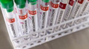 Monkeypox - Variole du singe - Tests - Contamination - 