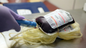 Poche de sang - Transfusion sanguine - Thalassémie